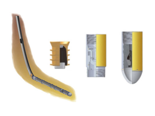 Buy CBS Casing Buoyancy System Oilfield Use Casing Buoyancy online manufacture